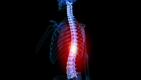 Orthopedic Conditions of the Spine, Dr Vasilios Pandis, Orthopedic