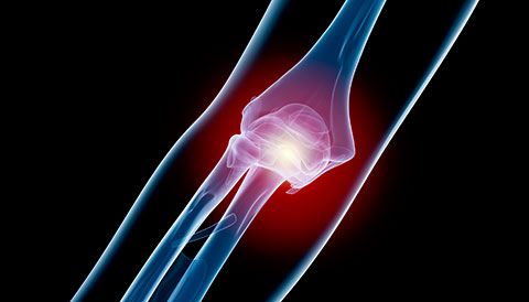 Orthopedic Conditions of the Elbow, Dr Vasilios Pandis, Orthopedic