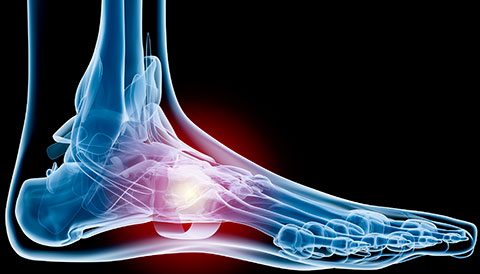 Orthopedic Conditions of the Foot, Dr Vasilios Pandis, Orthopedic