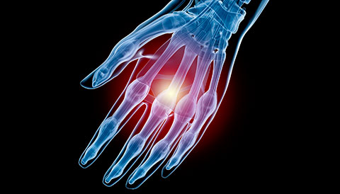 Orthopedic Conditions of the Hand, Dr Vasilios Pandis, Orthopedic