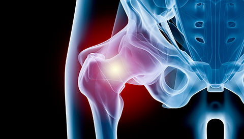 Orthopedic Conditions of the Hip, Dr Vasilios Pandis, Orthopedic