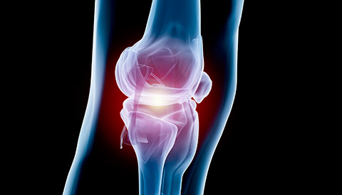 Orthopedic Conditions of the Knee, Dr Vasilios Pandis, Orthopedic