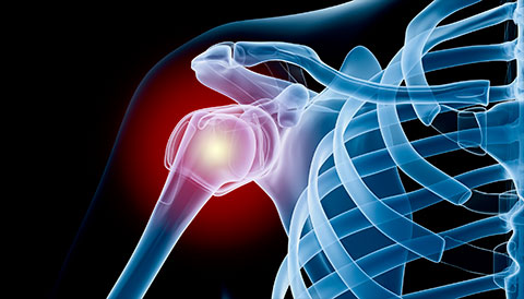 Orthopedic Conditions of the Shoulder, Dr Vasilios Pandis, Orthopedic
