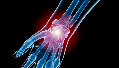 Orthopedic Conditions of the Wrist, Dr Vasilios Pandis, Orthopedic